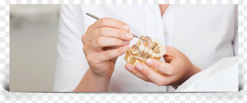 Dental Implants Dentistry Implant Dr. Robert C. Dost & Associates Pamela L. Hunte, D.D.S. PNG