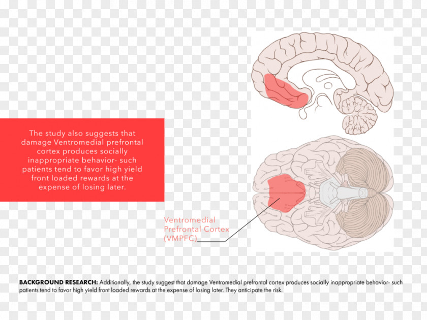 Brain Ventromedial Prefrontal Cortex Diagram Somatic Marker Hypothesis Chart PNG