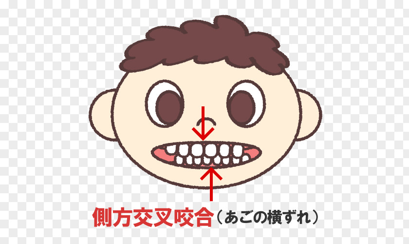 Captions 矯正歯科 Dentistry Prognathism PNG