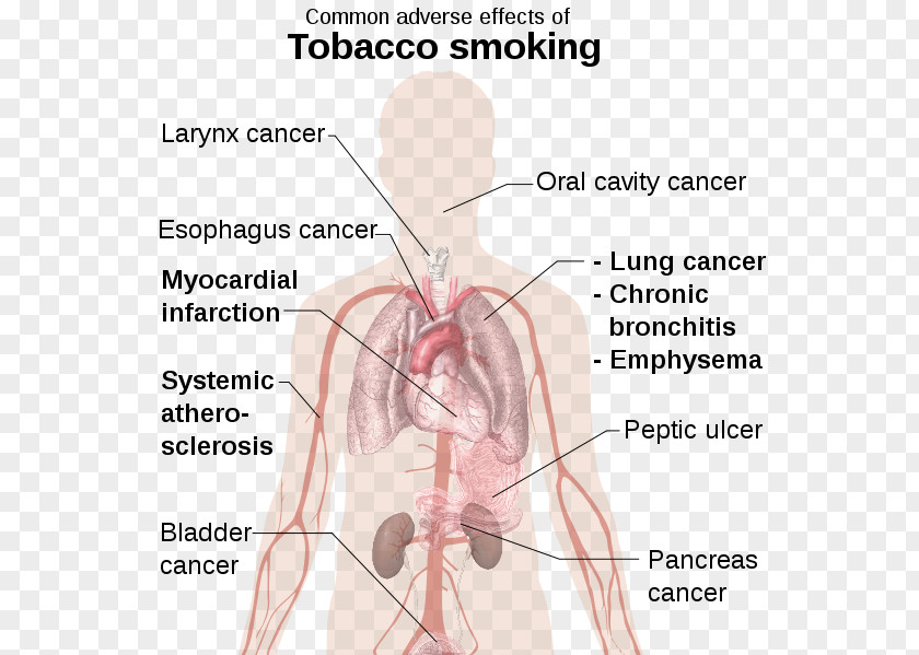 Health Tobacco Smoking Cessation Adverse Effect PNG