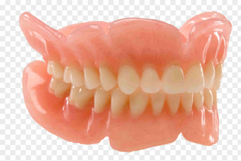 Teeth Model Dentures Dentistry Removable Partial Denture Dental Restoration PNG