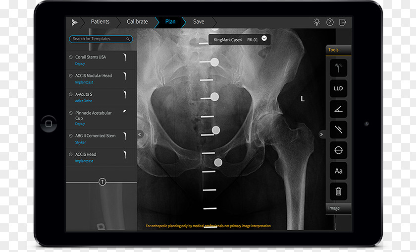 Mobile App Template Orthopedic Surgery Computer Software PNG