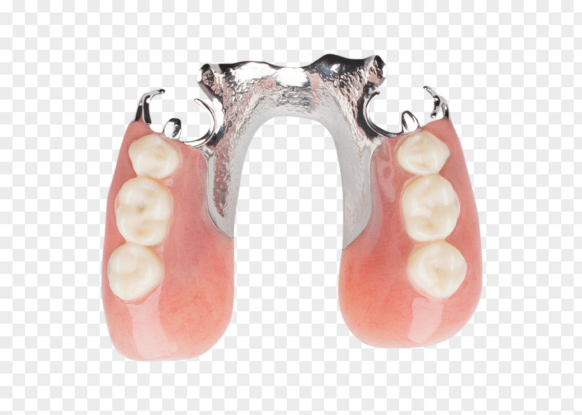 Aspen Dental Human Tooth Dentures Removable Partial Denture Dentistry PNG