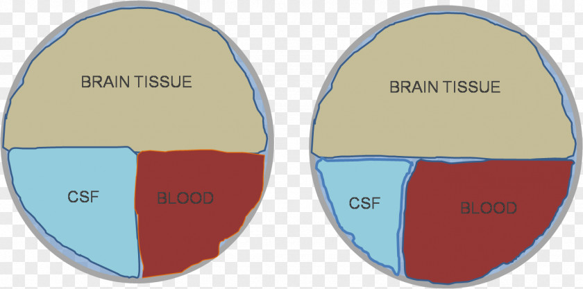 Forensic Central Nervous System Doktryna Monro-Kelliego Brain Skull PNG