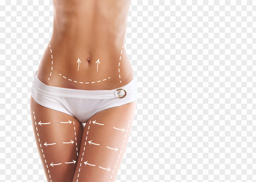 In Addition To Cellulite Plastic Surgery Surgeon Body Contouring Abdominoplasty PNG