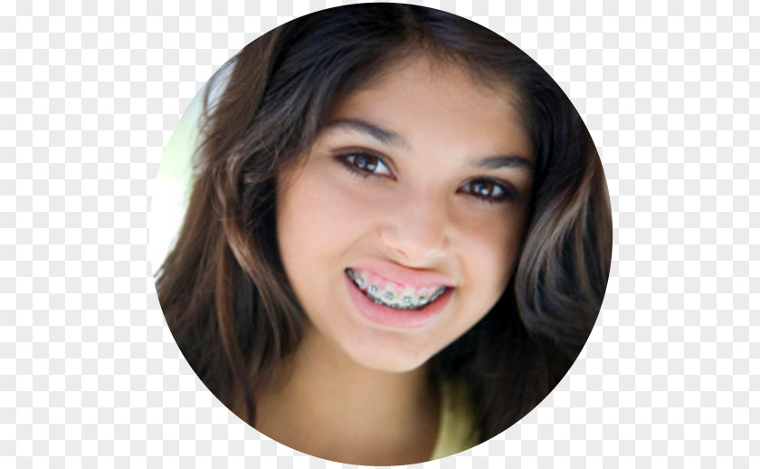 Child Orthodontics Dental Braces Dentistry Tooth PNG