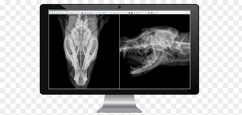 Medical Imaging Radiology Medicine X-ray Radiography PNG