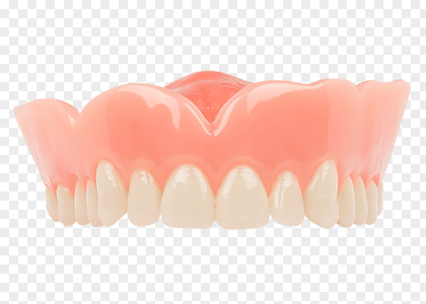 Crown Tooth Dentures Dentistry Aspen Dental PNG