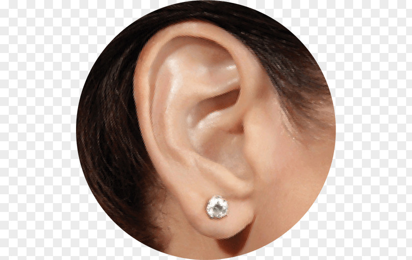 Ear CROS Hearing Aid Test Audiology PNG