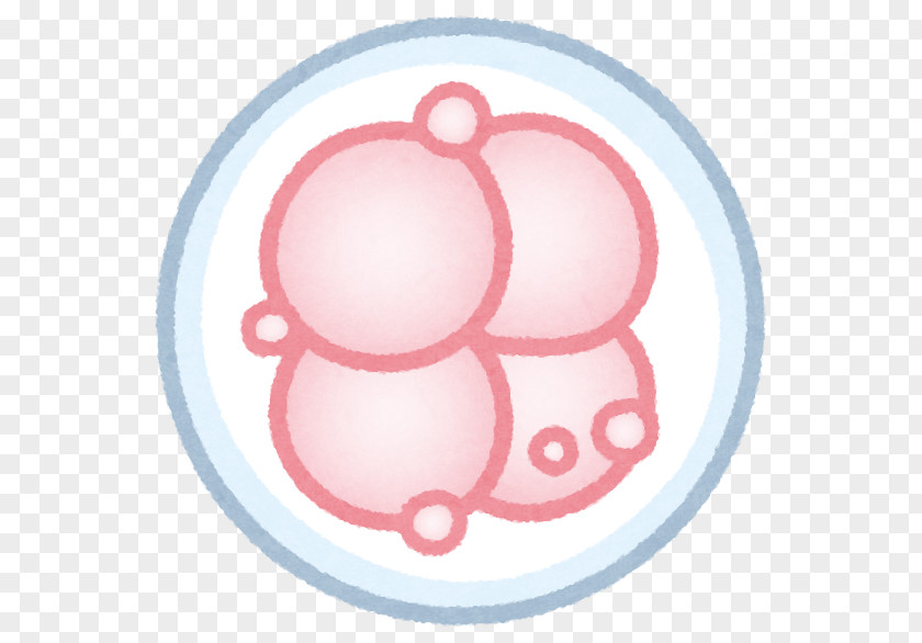 Pregnancy Polycystic Ovary Syndrome Embryo Infertility Transvaginal Oocyte Retrieval Fertilisation PNG