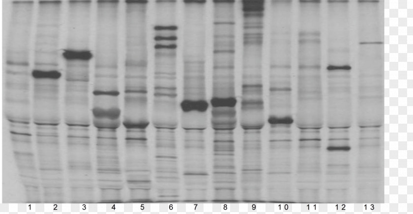 Autoantibody Polymyositis Antiphospholipid Syndrome Pattern PNG