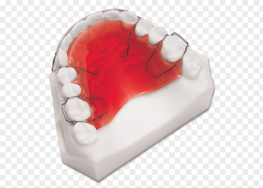 Retainer Orthodontics Dentistry Dental Laboratory PNG