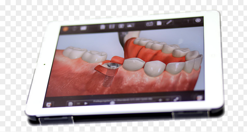 Doctor With Ipad IPad 2 Netbook Dentist Implantology Dental Implant PNG