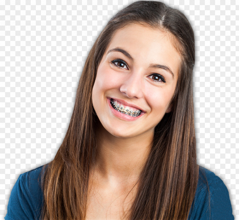 Ortodoncia Dental Braces Orthodontics Dentistry Clear Aligners PNG