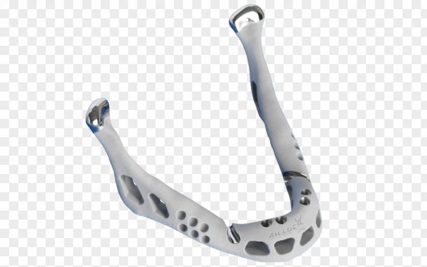 3d Printed Mandible Implant Prosthesis Jaw Surgery PNG