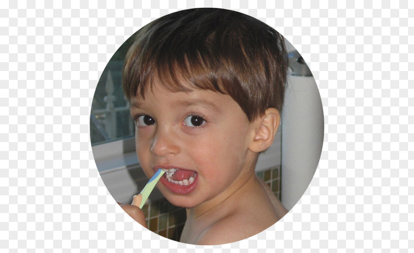 Child Cheek Tooth Decay Fluorine PNG