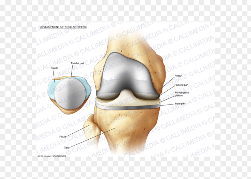 Muscular Development Bone Fracture Jaw Ear Human Tooth PNG