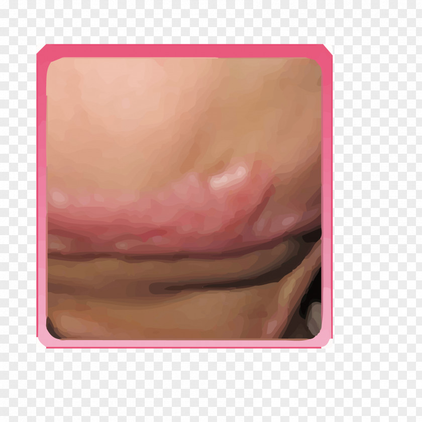 Skin Scars Lip Gloss Close-up PNG