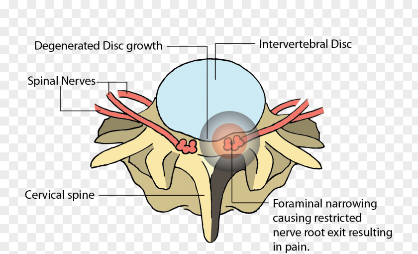 Ear Line Angle Jaw Clip Art PNG