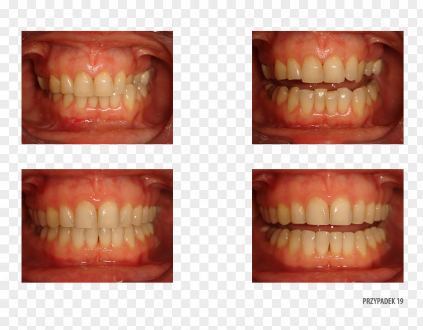 Tooth Therapy Patient Service Quality PNG