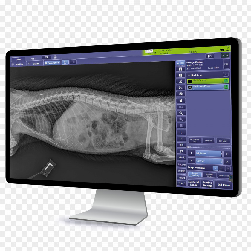 Porcupine Digital Radiography Canon Medical Systems Corporation Computer Monitors Imaging PNG