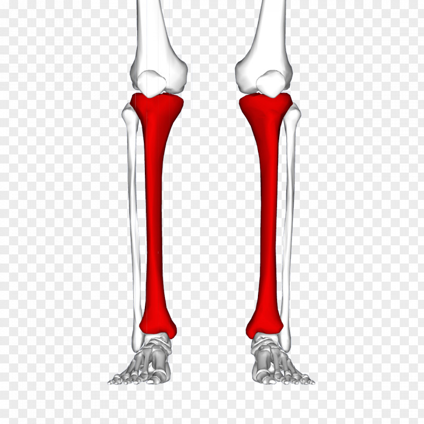 Shin Splints Tibia Pain Human Leg Injury PNG splints leg Injury, bone clipart PNG