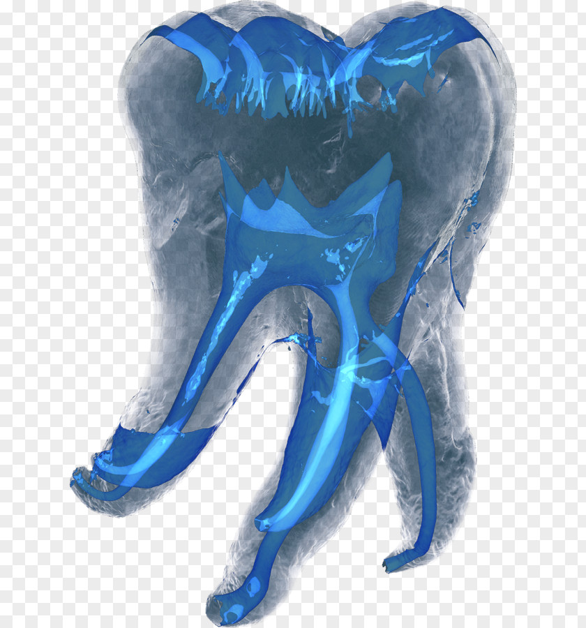 3d Tooth Dentistry Computed Tomography PNG