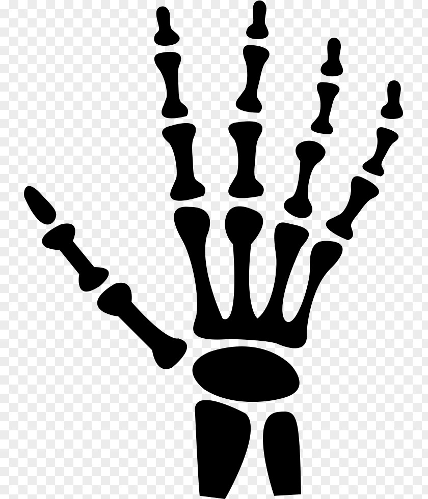 Hand Carpal Bones Human Skeleton PNG