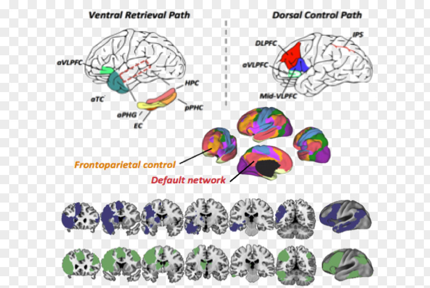 Brain Ventrolateral Prefrontal Cortex Cognition Functional Magnetic Resonance Imaging PNG