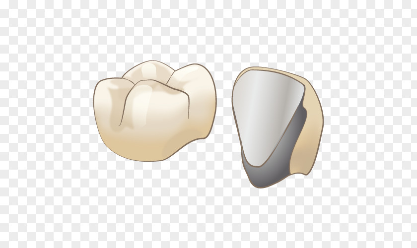 Tooth Crown 審美歯科 Dentist オールセラミック Therapy PNG