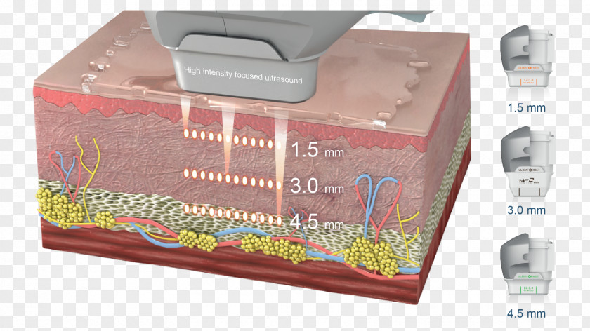 Face High-intensity Focused Ultrasound Rhytidectomy Skin Lux Medical Aesthetics Clinic PNG