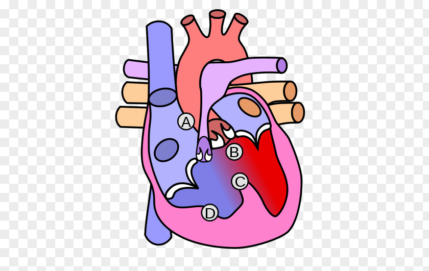 Heart Valve Clip Art Diagram Tetralogy Of Fallot PNG