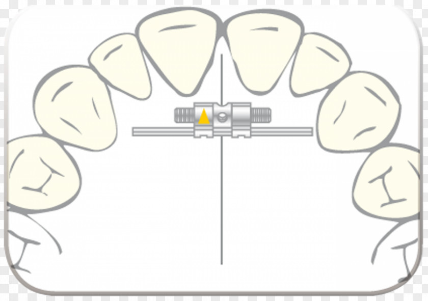 Flecha Indicadora Scheu-Dental Nadimco AG Text Finger PNG