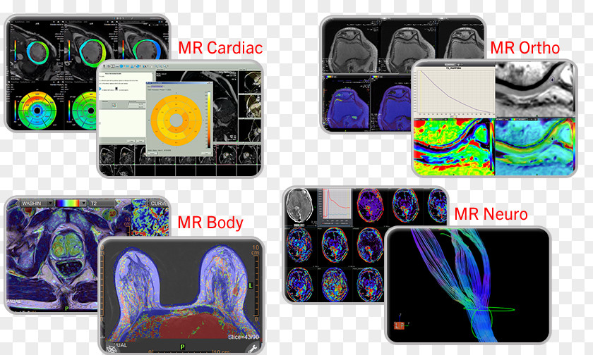 Nuclear Medicine Canon Medical Systems Corporation Magnetic Resonance Imaging PNG