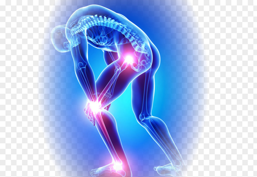 Pain Knee Joint Osteoarthritis PNG