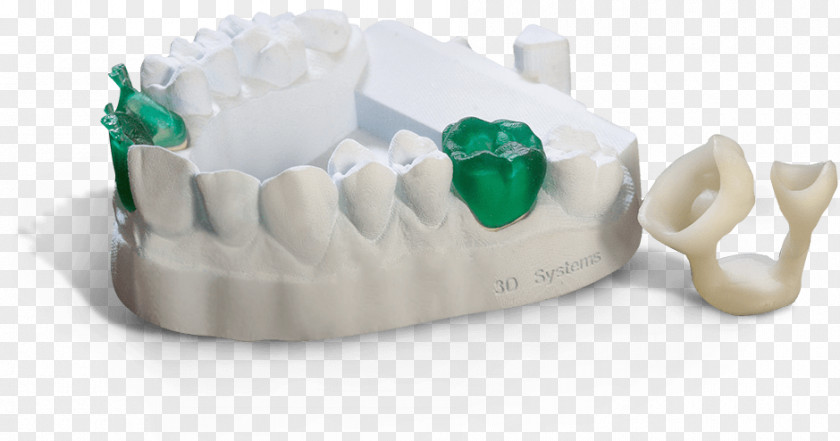 Teeth Model 3D Printing Plastic Systems Stereolithography PNG