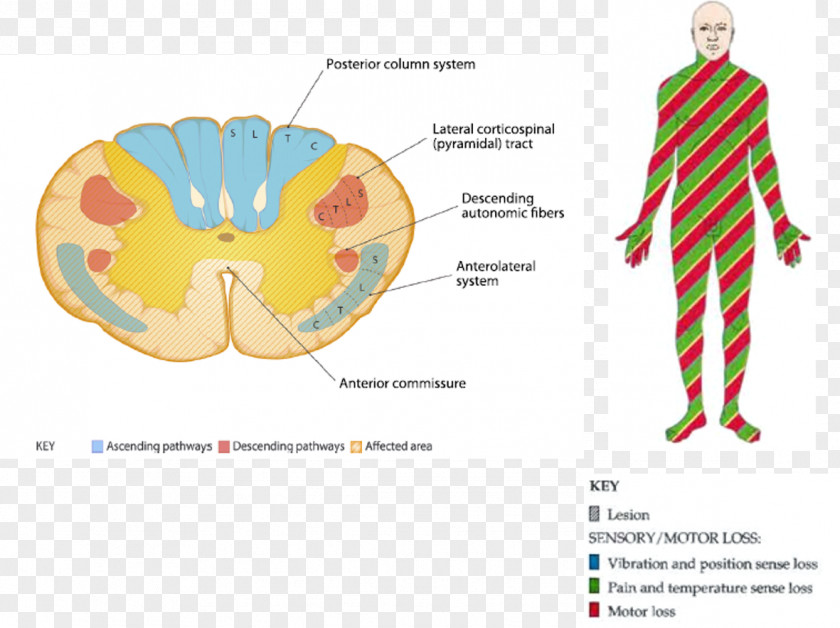 Fecal Incontinence Graphic Design Neuroanatomy Neuroscience Brain Ache PNG
