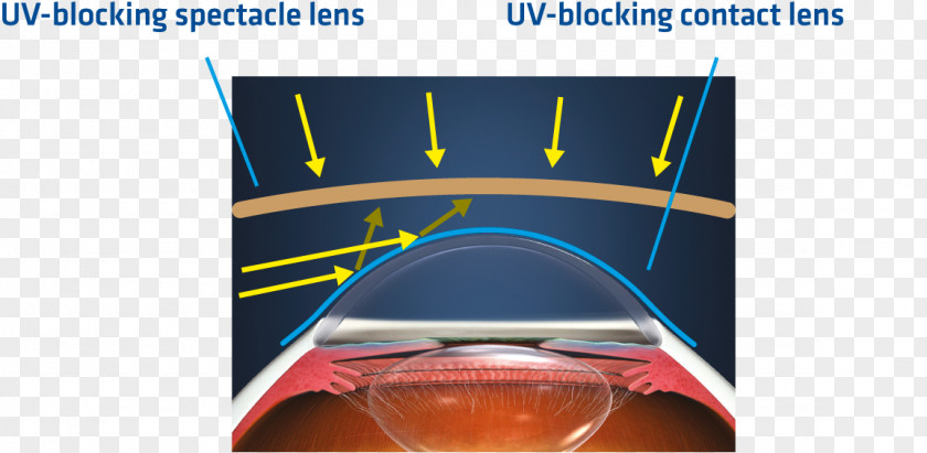 Contact Lenses Johnson & Ultraviolet Glasses PNG