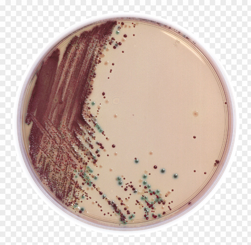 Coli 2011 Germany E. O104:H4 Outbreak Escherichia O157:H7 Shigatoxigenic And Verotoxigenic Pathogenic PNG