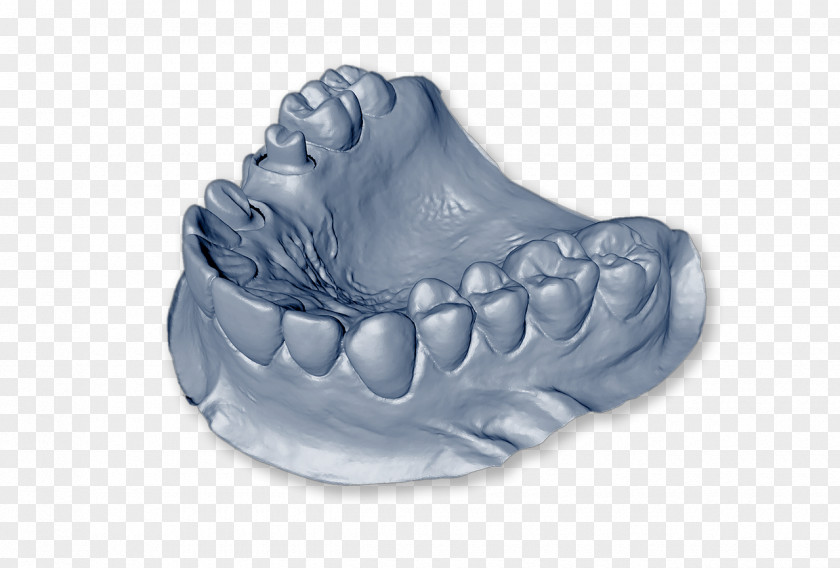 Dental Model Dentistry Tooth Laboratory Dentures Technician PNG