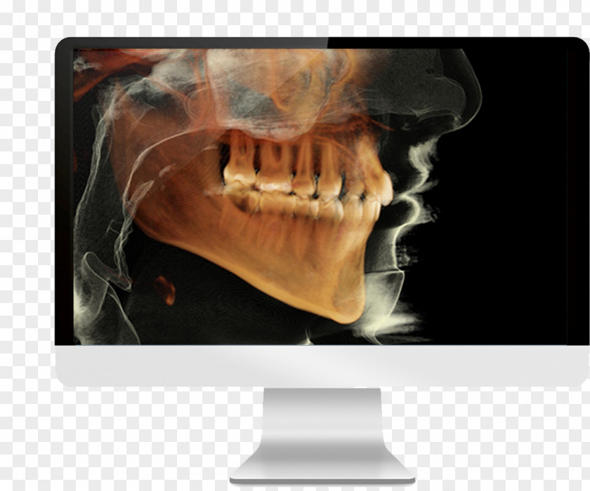 Cone Beam Computed Tomography Dental Radiography Dentistry PNG