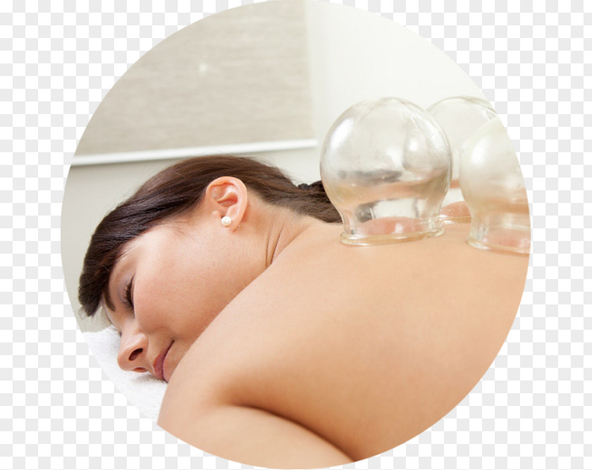 Cupping Therapy Alternative Health Services Centro Médico Jardins Massage Ventosa PNG