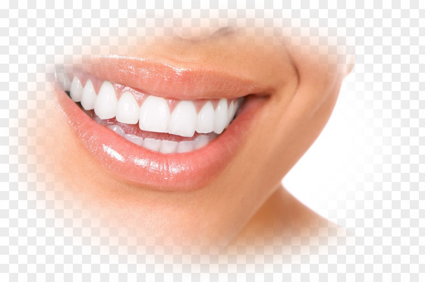 Dent Dentures Dentistry Gums Dental Implant PNG