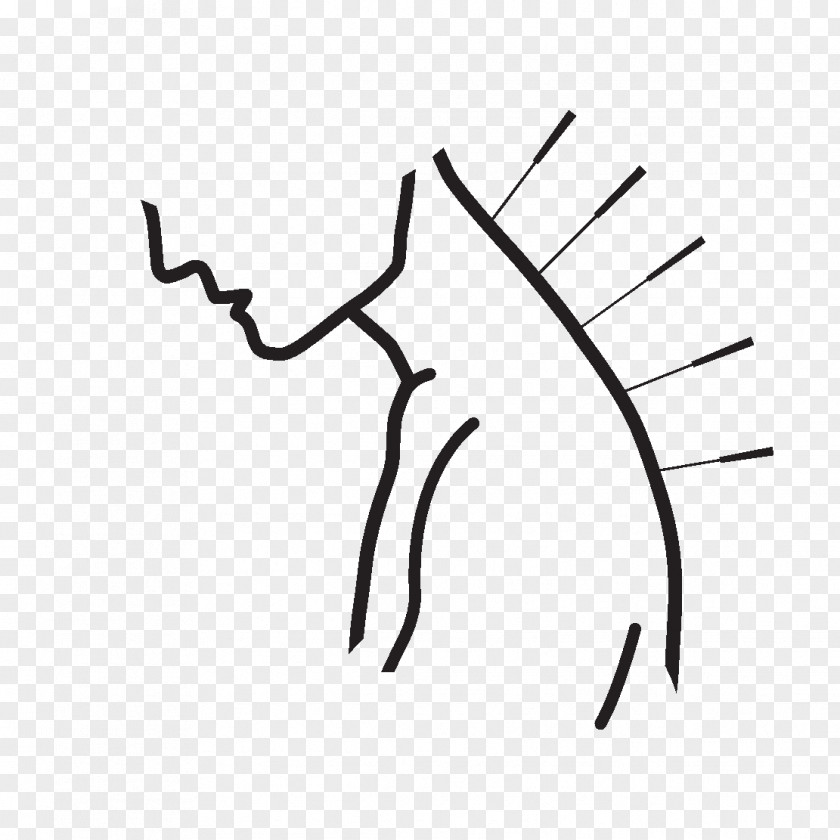 Acupuncture Royalty-free Medicine Clip Art PNG