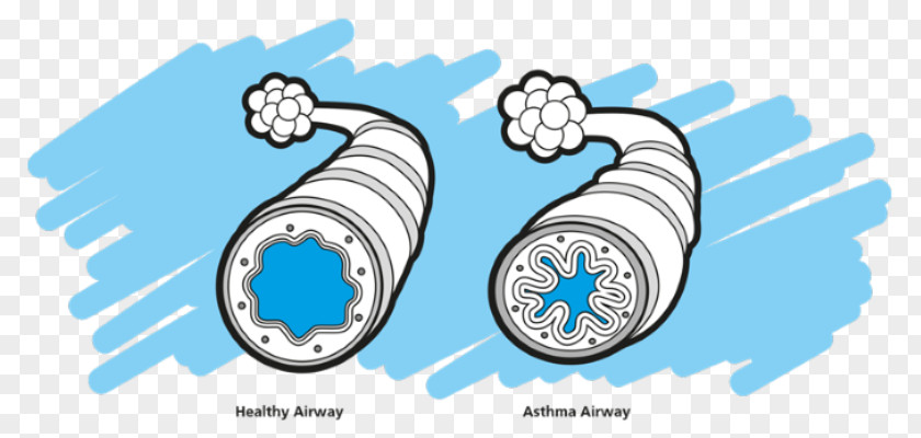 Asthma Spacer Montelukast Nursing Care Clip Art PNG