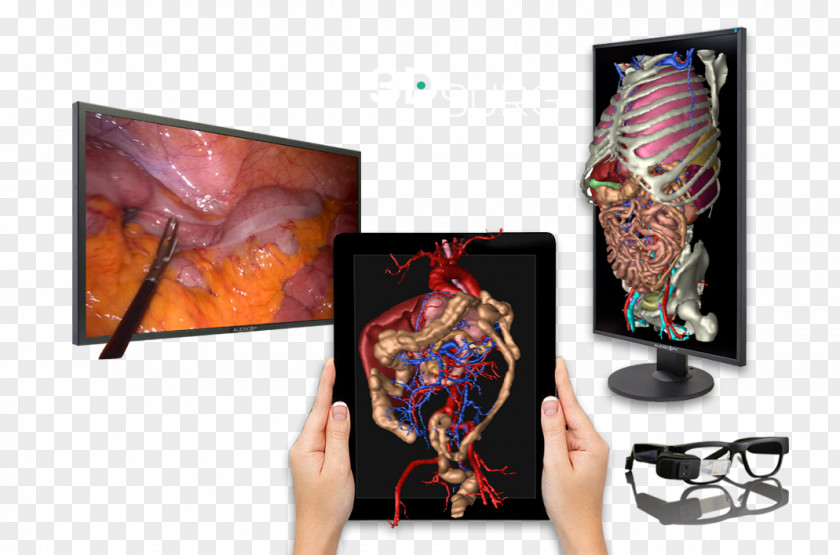 Surgical Technologist Surgery Patient Information Three-dimensional Space Medicine PNG