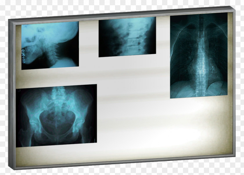 Light The Sims 4 Lightbox X-ray PNG