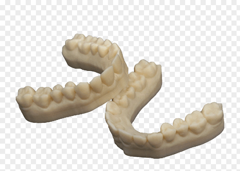 3d Tooth Repair 3D Printing Dentistry Dental Composite Crown PNG