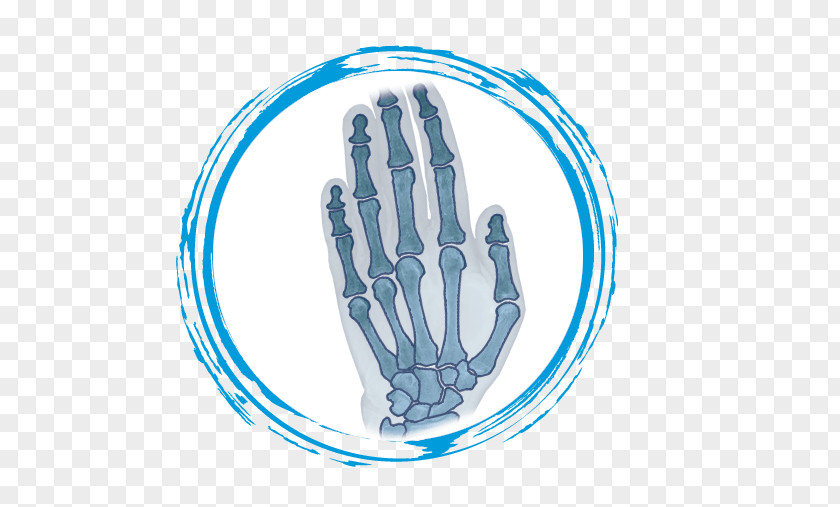 TraumatologoSabadell Traumatology Foot Thumb WristPartes De La Mano Y Muneca Novamedicum Dr Cabestany PNG