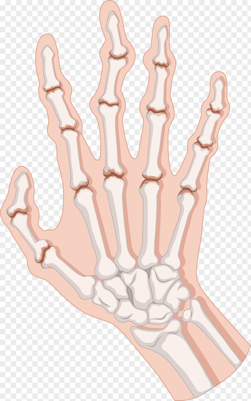 Body Palm Bones Rheumatoid Arthritis Clip Art PNG